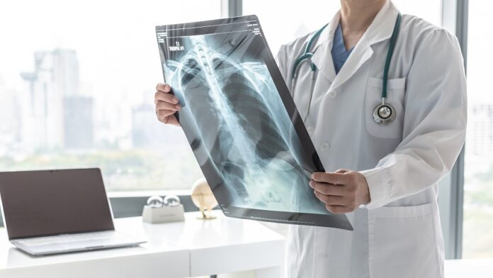 bronchopneumopathie obstructive radiologie