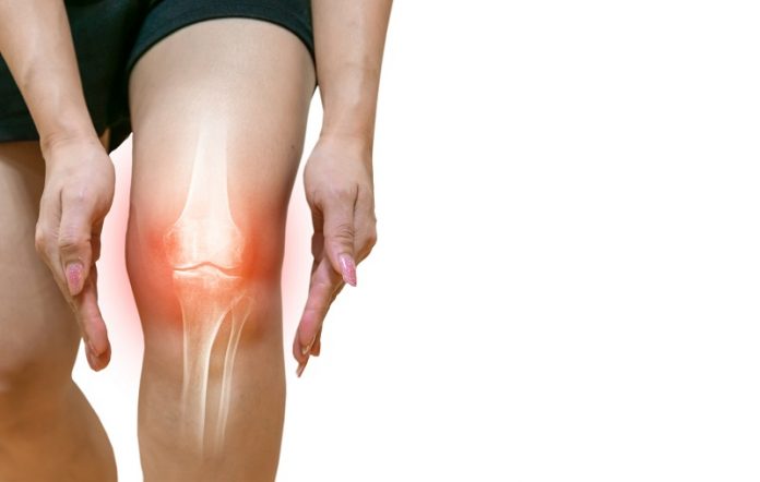 Ruptures des ligaments des genoux : femme