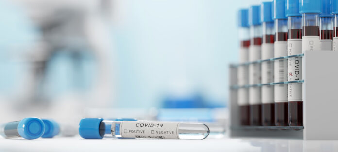 Covid-19 : le nombre des nouvelles contaminations ne baissent plus