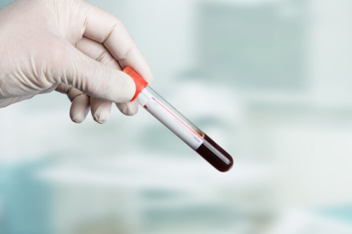 Grossesse: comment comprendre le résultat de la prise de sang