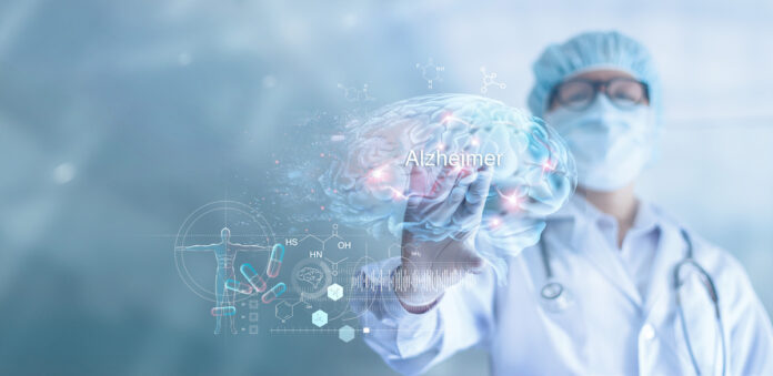 Covid: the virus increases the risk of Alzheimer's by 50 to 80% Covid: the virus increases the risk of Alzheimer's by 50 to 80%
