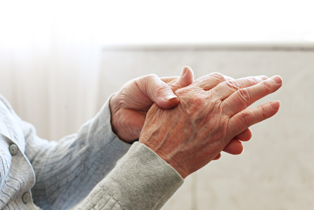 Arthrose de la main : bientôt un nouveau médicament anti-inflammatoire ?