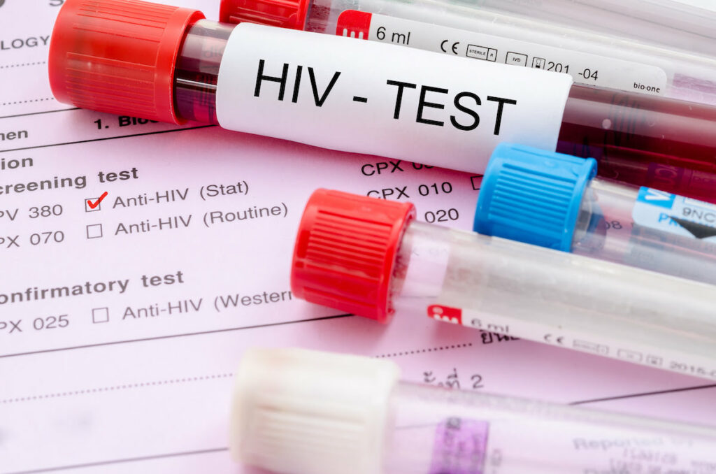 Santé : un troisième cas de guérison du VIH