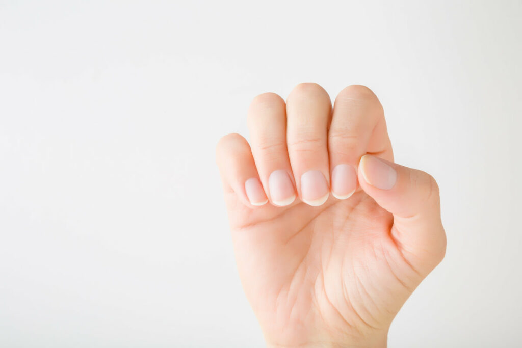 Cancer de la peau : comment reconnaître un mélanome sous l’ongle ?