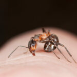 Piqûre de fourmi : comment la soigner ?