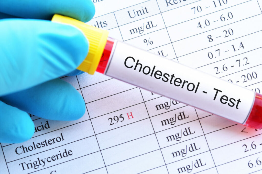 5 plantes médicinales pour lutter contre le cholestérol