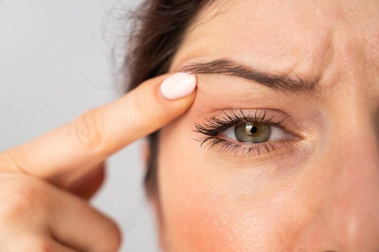 Paupière qui tremble (fasciculation) : causes et solutions - La Santé