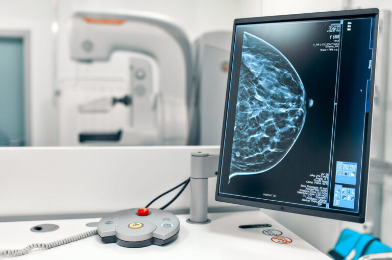 Cancer du sein : la mammographie à reculons