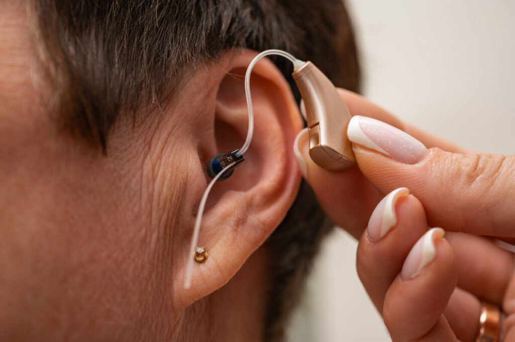 C’est quoi l'escroquerie à la prothèse auditive ?