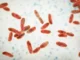 Comment se protéger des infections à Mycoplasma pneumoniae qui progressent en France ?