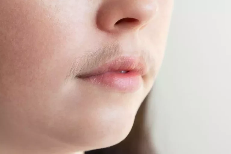 "Moustache" chez les femmes : comment s'en débarrasser ?