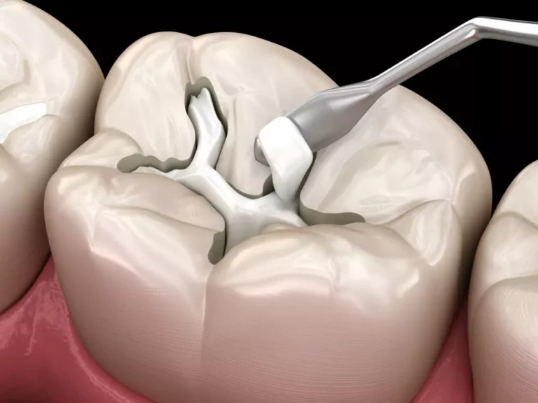 Bientôt un médicament révolutionnaire pour faire repousser les dents