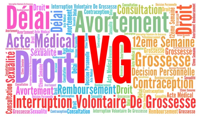 ivg