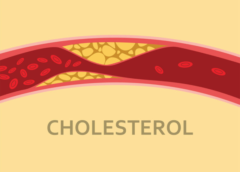 Ce fruit aide à baisser le cholestérol, révèle une étude