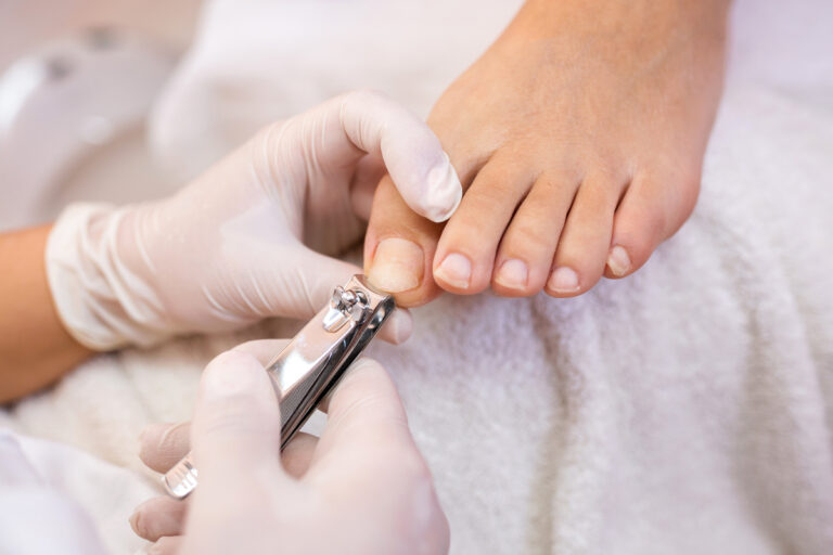 ongles