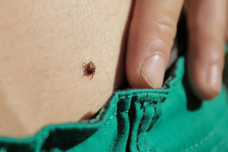 Maladie de Lyme : ces gestes &agrave; conna&icirc;tre absolument apr&egrave;s une morsure de tique